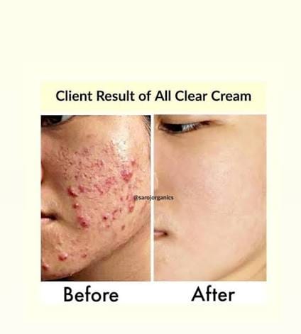 Crème apaisante 345 Relief Cream de Dr.Althea