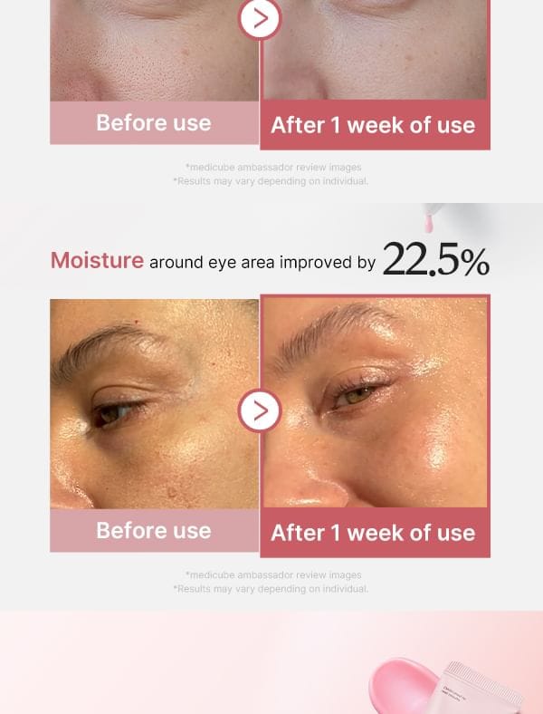 Crème Contour des Yeux PDRN Saumon, Rétinol & Peptides — Anti-Rides & Anti-Poches